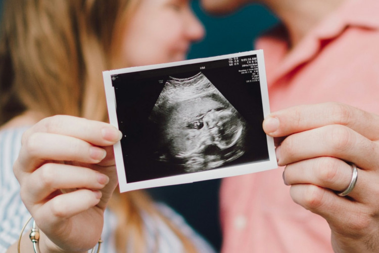 Seks måneders godtgørelse til opsagt medarbejder i planlagt fertilitetsbehandling